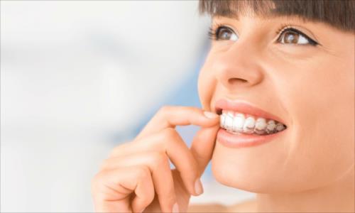 Ortodoncja może być estetyczna